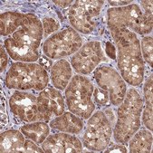 Anti-CLPX antibody produced in rabbit Prestige Antibodies&#174; Powered by Atlas Antibodies, affinity isolated antibody, buffered aqueous glycerol solution