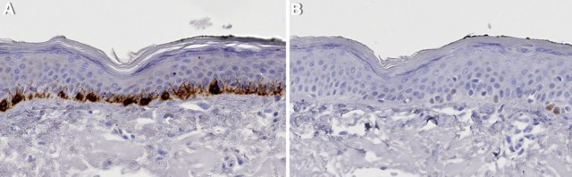 Anti-TYRP1 Antibody, clone 3L4 ZooMAb&#174; Rabbit Monoclonal recombinant, expressed in HEK 293 cells
