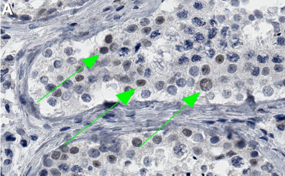 Anti-DNMT3B Antibody, clone 2N12 ZooMAb&#174; Rabbit Monoclonal recombinant, expressed in HEK 293 cells
