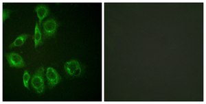 Anti-PKC-PAN antibody produced in rabbit affinity isolated antibody