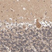 Anti-ARHGEF7 antibody produced in rabbit Prestige Antibodies&#174; Powered by Atlas Antibodies, affinity isolated antibody, buffered aqueous glycerol solution