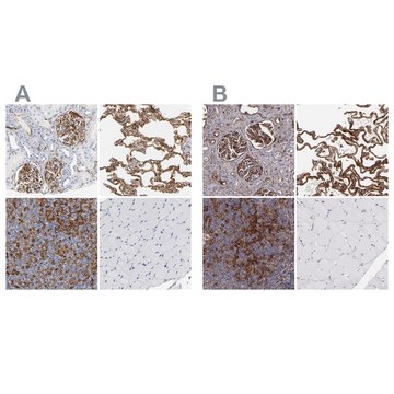 Anti-ICAM1 antibody produced in rabbit Prestige Antibodies® Powered by Atlas Antibodies, affinity isolated antibody, buffered aqueous glycerol solution