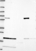 Anti-ALDH4A1 antibody produced in rabbit Prestige Antibodies&#174; Powered by Atlas Antibodies, affinity isolated antibody, buffered aqueous glycerol solution