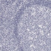 Anti-DNALI1 antibody produced in rabbit Prestige Antibodies&#174; Powered by Atlas Antibodies, affinity isolated antibody, buffered aqueous glycerol solution