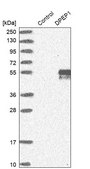 Anti-DPEP1 antibody produced in rabbit Prestige Antibodies&#174; Powered by Atlas Antibodies, affinity isolated antibody, buffered aqueous glycerol solution