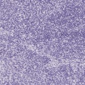 Anti-PNLIP antibody produced in rabbit Prestige Antibodies&#174; Powered by Atlas Antibodies, affinity isolated antibody, buffered aqueous glycerol solution