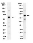 Anti-Forkhead box protein K2 (FOXK2) from rabbit, purified by affinity chromatography