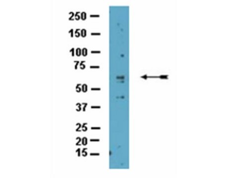 Anti-CARM1 Antibody from rabbit
