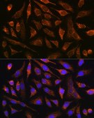 Anti-MMP13 antibody produced in rabbit