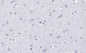 Anti-GAP43 Antibody, clone 1D6 , ZooMAb&#174; Rabbit Monoclonal recombinant, expressed in HEK 293 cells