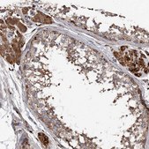Anti-ASCC3 antibody produced in rabbit Prestige Antibodies® Powered by Atlas Antibodies, affinity isolated antibody, buffered aqueous glycerol solution, ab2