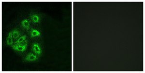 Anti-PI3-kinase p85-&#945; antibody produced in rabbit affinity isolated antibody