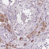 Anti-WWOX antibody produced in rabbit Prestige Antibodies&#174; Powered by Atlas Antibodies, affinity isolated antibody, buffered aqueous glycerol solution