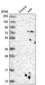 Anti-AFP antibody produced in rabbit Prestige Antibodies® Powered by Atlas Antibodies, affinity isolated antibody, buffered aqueous glycerol solution