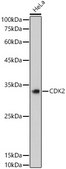 [KO Validated]Anti-CDK2 Antibody, clone 10E0N5, Rabbit Monoclonal