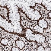 Anti-SRSF6 antibody produced in rabbit Prestige Antibodies&#174; Powered by Atlas Antibodies, affinity isolated antibody, buffered aqueous glycerol solution