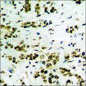 Anti-phospho-JAK1 (pTyr1022) antibody produced in rabbit affinity isolated antibody
