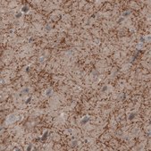 Monoclonal Anti-MOG antibody produced in mouse Prestige Antibodies&#174; Powered by Atlas Antibodies, clone CL2852, purified immunoglobulin, buffered aqueous glycerol solution