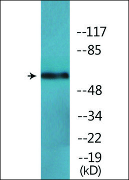 Anti-phospho-RelB (pSer552) antibody produced in rabbit affinity isolated antibody
