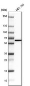 Anti-STK3 antibody produced in rabbit Prestige Antibodies&#174; Powered by Atlas Antibodies, affinity isolated antibody, buffered aqueous glycerol solution