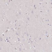 Anti-TNFRSF10A antibody produced in rabbit Prestige Antibodies&#174; Powered by Atlas Antibodies, affinity isolated antibody, buffered aqueous glycerol solution