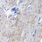 Anti-Cathepsin D Antibody, clone 2B3E8, Rabbit Monoclonal