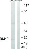 Anti-MRPL40 antibody produced in rabbit affinity isolated antibody