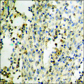 Anti-phospho-PYK2 (pTyr579) antibody produced in rabbit affinity isolated antibody