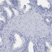 Anti-HAPLN1 antibody produced in rabbit Prestige Antibodies&#174; Powered by Atlas Antibodies, affinity isolated antibody, buffered aqueous glycerol solution, Ab2