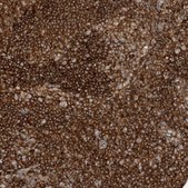 Anti-CAPZB antibody produced in rabbit Prestige Antibodies&#174; Powered by Atlas Antibodies, affinity isolated antibody, buffered aqueous glycerol solution