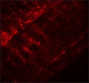 Anti-SYNPO2 antibody produced in rabbit affinity isolated antibody, buffered aqueous solution