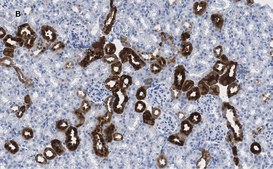 Anti-Calbindin D-28K clone 1A11 Antibody, ZooMAb&#174; Rabbit Monoclonal recombinant, expressed in HEK 293 cells