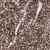 Anti-WT1 antibody produced in mouse Prestige Antibodies&#174; Powered by Atlas Antibodies, clone CL13165, purified by using Protein A, buffered aqueous glycerol solution
