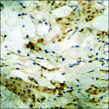 Anti-phospho-ATF2 (pThr73 or 55) antibody produced in rabbit affinity isolated antibody