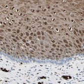 Anti-S100A9 antibody produced in rabbit Prestige Antibodies&#174; Powered by Atlas Antibodies, affinity isolated antibody, buffered aqueous glycerol solution