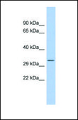 Anti-MBP antibody produced in rabbit affinity isolated antibody
