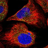 Anti-AGPS antibody produced in rabbit Prestige Antibodies&#174; Powered by Atlas Antibodies, affinity isolated antibody, buffered aqueous glycerol solution, ab1