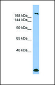 Anti-MYH1, (N-terminal) antibody produced in rabbit affinity isolated antibody