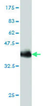 Monoclonal Anti-SPAST antibody produced in mouse clone 3A12, purified immunoglobulin, buffered aqueous solution