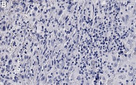 Anti-p-Rb-Ser807/811 Antibody, clone 3J7 ZooMAb&#174; Rabbit Monoclonal recombinant, expressed in HEK 293 cells