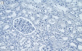 Anti-MTAP Antibody, clone 1H20 ZooMAb&#174; Rabbit Monoclonal recombinant, expressed in HEK 293 cells