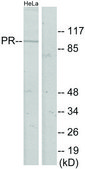Anti-Progesterone Receptor antibody produced in rabbit affinity isolated antibody