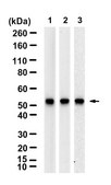 Anti-CYP11A1 Antibody, clone 2M5 ZooMAb&#174; Rabbit Monoclonal recombinant, expressed in HEK 293 cells