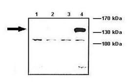Anti-ACTN4 (AB2) antibody produced in rabbit IgG fraction of antiserum