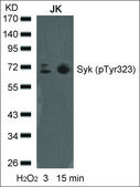 Anti-phospho-SYK (pTyr323) antibody produced in rabbit affinity isolated antibody