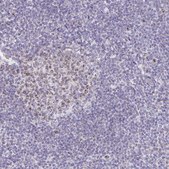Anti-CENPH antibody produced in rabbit Prestige Antibodies&#174; Powered by Atlas Antibodies, affinity isolated antibody, buffered aqueous glycerol solution