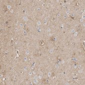 Anti-GPER1 antibody produced in rabbit Prestige Antibodies&#174; Powered by Atlas Antibodies, affinity isolated antibody, buffered aqueous glycerol solution