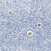 Anti-SALL4 antibody produced in rabbit Prestige Antibodies® Powered by Atlas Antibodies, affinity isolated antibody, buffered aqueous glycerol solution