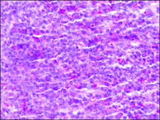 Anti-ITGA4 (AB1) antibody produced in rabbit affinity isolated antibody, buffered aqueous solution
