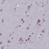 Anti-PABPC1 antibody produced in rabbit Prestige Antibodies&#174; Powered by Atlas Antibodies, affinity isolated antibody, buffered aqueous glycerol solution